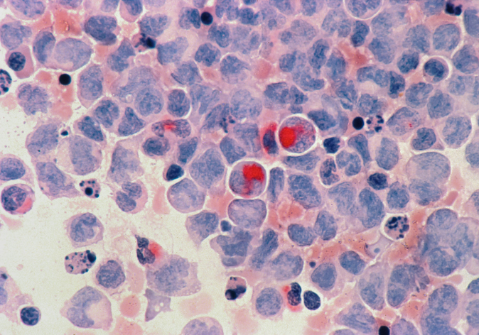 Does NAD+ Increase Cancer Risk?